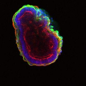 Stem cells self-organize to form a hollow ball of cells. (Image by In Kyoung Mah and Francesca Mariani) channels=3 mode=color unit=um spacing=1.0E-13 loop=false